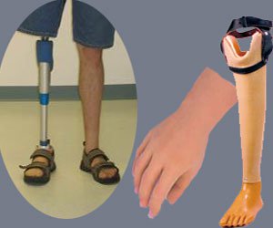 कृत्रिम हातखुट्टा शिविरबाट ३५ लाभान्वित