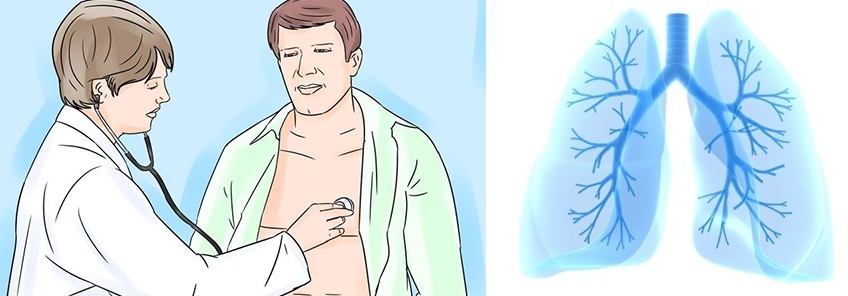 अबको १३ वर्षमा क्षयरोगको समस्या ९० प्रतिशतले घट्ने: 11 संगठन