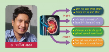 मिर्गौलामा पत्थरी : यस्ता छन् लक्षण, उपचार के?