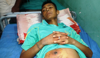 जब झाँक्रीले जण्डिस भएको बिरामीको पेट चिरिदिए...