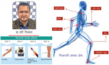 पिआरपी : दुखाइ कम गर्ने आधुनिक प्रविधि 