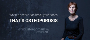 विश्व आस्टियोपोरोसिस  दिवसको अवसरमा ३ दिने निः शुल्क स्वास्थ्य शिविर