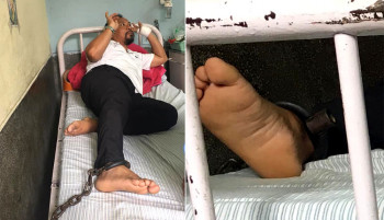 वीर अस्पतालमा उपचाररत रेशम चौधरीको खुट्टामा बाँधिएको फलामे साङ्लो हटाइयो