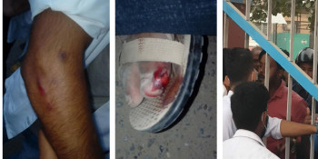 ज्ञापनपत्र बुझाउन गएका युनिभर्सल मेडिकल कलेजका विद्यार्थीमाथि हातपात