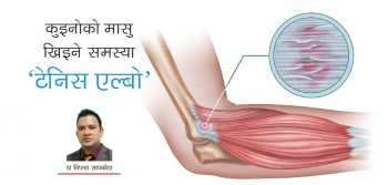 कुइनोको मासु खिइने समस्या ‘टेनिस एल्बो’का लक्षण र उपचार 