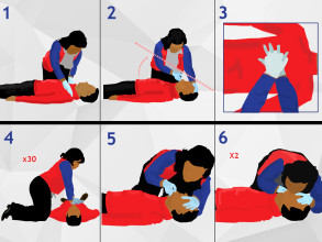 सीपीआर- एउटा जीवनरक्षक प्रक्रियाबारे किन जान्नुपर्छ ?