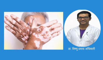 विश्व सेतो दुबी दिवस: रोग छालाको,  प्रश्न चेतनाको