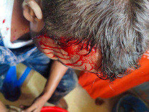 बीरगञ्जको नारायणी अस्पतालमा बिरामीको मृत्युपछि चिकित्सकमाथि साघातिक आक्रमण, चिकित्सक संघको विरोध
