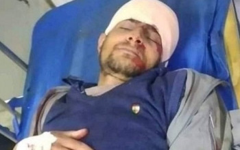 एमसिसीविरुद्धको आन्दोलनमा घाइते अवस्थी अस्पतालबाट डिस्चार्ज