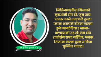 गिजाको स्वास्थ्य : रोकथाम र उपचार- जनसाधारणका लागि बुझ्न सजिलो जानकारी