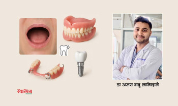 दन्तविहीन अवस्थामा कस्तो दाँत राख्ने?