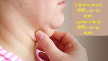 मोटो गर्दनले गर्न सक्छ यी रोगको संकेत