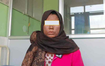 दुर्लभ रोग ‘सामान्यीकृत पस्टुलर सोरायसिस’ भएकी महिलाको नेपाल मेडिकल कलेजमा सफल उपचार