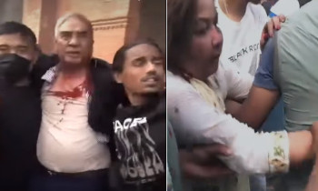 शेरबहादुर देउवाको टाउकोमा १२ टाँका लगाइएको छ: कांग्रेस