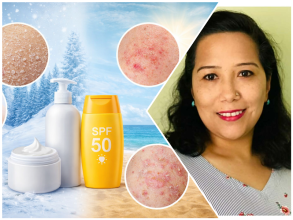 जाडो र छाला स्वास्थ्य : बेवास्ता गर्दा बढ्न सक्छ समस्या