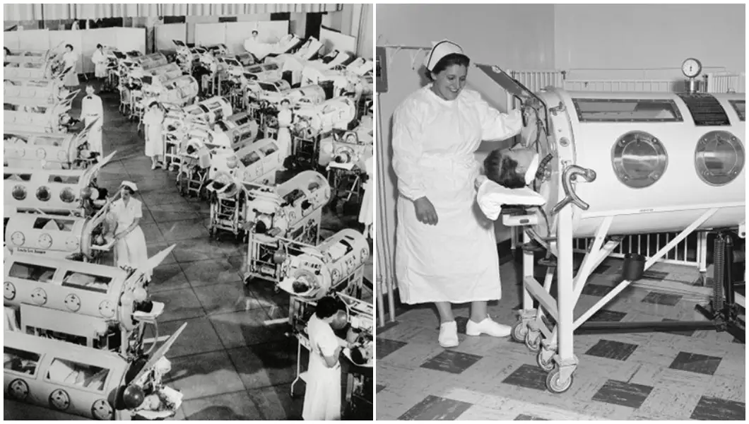 iron-lung-patients-and-nurses-split-image_tcm25-741912-1715668537.webp