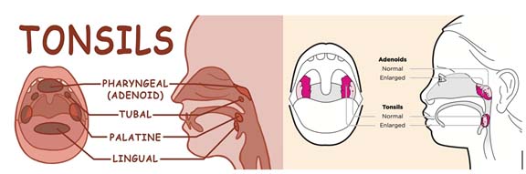 tonsil1-1763279244.jpg